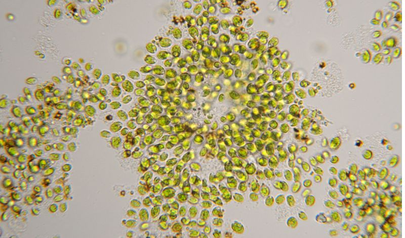 Unter dem Mikroskop kann man die kugelförmige Struktur der Chlorella erkennen - und ihre ziemlich dicke Zellmembran.